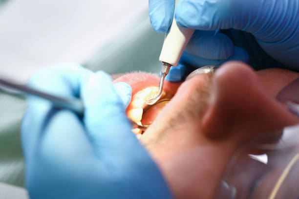 Best Emergency Treatment for Jaw Pain or Injury in Butler, OH