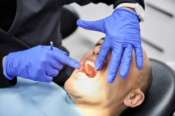 Best Dental Abscess Treatment in Butler, OH