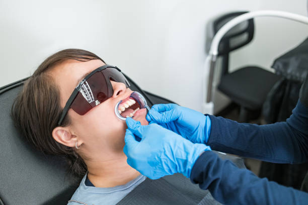 Best Knocked-Out Tooth (Avulsed Tooth) Treatment in Butler, OH